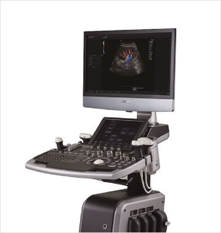 초음파영상진단기